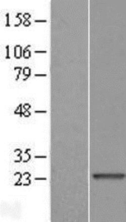 Novus Biologicals&trade;&nbsp;TXLNGY Overexpression Lysate