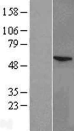 Novus Biologicals&trade;&nbsp;CYP11A1 Overexpression Lysate