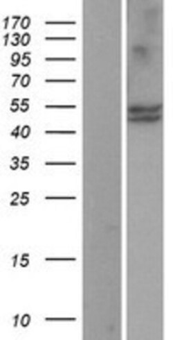 Novus Biologicals™ CYP11B1 Overexpression Lysate