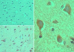 CYP1B1 Antibody, Novus Biologicals:Antibodies:Primary Antibodies