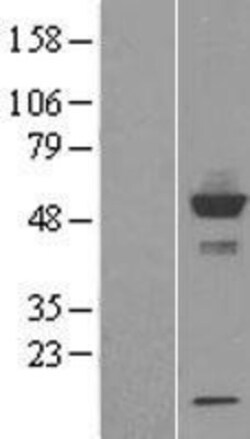Novus Biologicals&trade;&nbsp;CYP20A1 Overexpression Lysate
