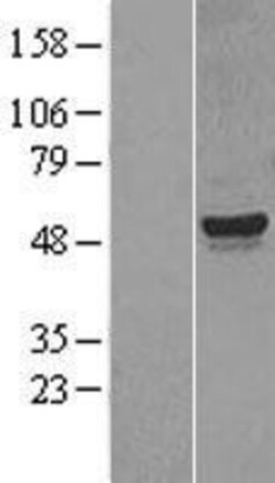 Novus Biologicals&trade;&nbsp;CYP26A1 Overexpression Lysate