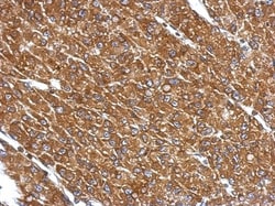 CYP27A1 Antibody, Novus Biologicals 0.1mL; Unlabeled:Antibodies, Polyclonal