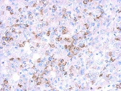 CYP27A1 Antibody, Novus Biologicals 0.1mL; Unlabeled:Antibodies, Polyclonal