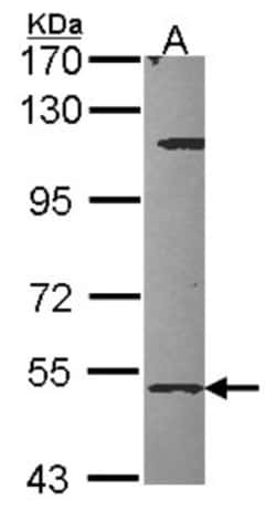 CYP27A1 Antibody, Novus Biologicals 0.1mL; Unlabeled:Antibodies, Polyclonal