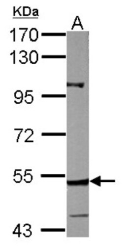 CYP27A1 Antibody, Novus Biologicals 0.1mL; Unlabeled:Antibodies, Polyclonal