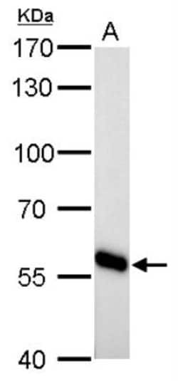CYP27A1 Antibody, Novus Biologicals 0.1mL; Unlabeled:Antibodies, Polyclonal