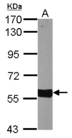 CYP27A1 Antibody, Novus Biologicals 0.1mL; Unlabeled:Antibodies, Polyclonal