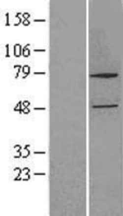 Novus Biologicals&trade;&nbsp;CYP27B1 Overexpression Lysate
