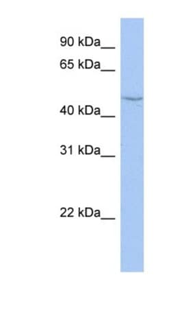 CYP27C1 Antibody, Novus Biologicals:Antibodies:Primary Antibodies