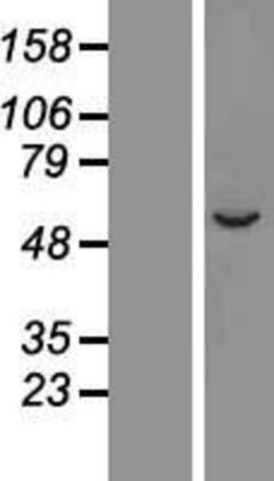 Novus Biologicals&trade;&nbsp;CYP2A7 Overexpression Lysate
