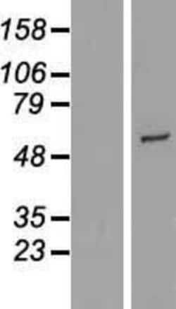 Novus Biologicals&trade;&nbsp;CYP2R1 Overexpression Lysate