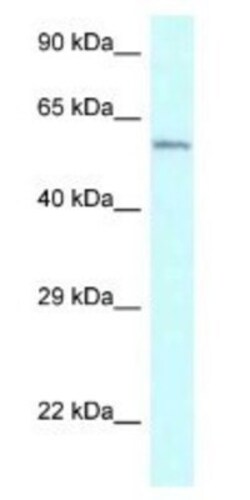 CYP2U1 Antibody, Novus Biologicals:Antibodies:Primary Antibodies