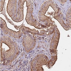 CYP2U1 Antibody, Novus Biologicals:Antibodies:Primary Antibodies