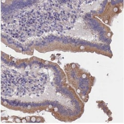 CYP2U1 Antibody, Novus Biologicals 25 &mu;L, Unlabeled:Antibodies, Polyclonal