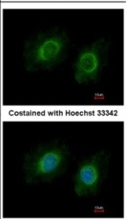 CYP3A43 Antibody, Novus Biologicals 0.1 mL | Buy Online | Novus Biologicals | Fisher Scientific