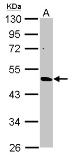 CYP3A43 Antibody, Novus Biologicals 0.1 mL | Buy Online | Novus Biologicals | Fisher Scientific