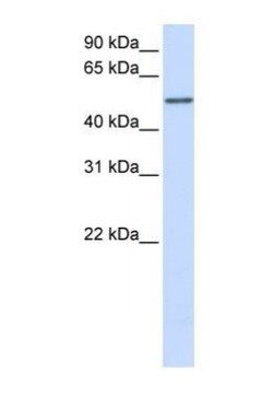 CYP3A43 Antibody, Novus Biologicals 0.05mg; Unlabeled:Antibodies, Polyclonal