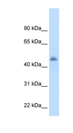 CYP3A7 Antibody, Novus Biologicals:Antibodies:Primary Antibodies
