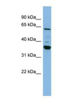 CYP3A7 Antibody, Novus Biologicals 100 &mu;L | Buy Online | Novus Biologicals | Fisher Scientific