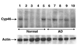 CYP46A1 Antibody, Novus Biologicals 0.025mL; Unlabeled:Antibodies, Polyclonal