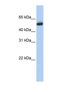 CYP4B1 Antibody, Novus Biologicals 100 &mu;L | Buy Online | Novus Biologicals | Fisher Scientific