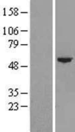 Novus Biologicals&trade;&nbsp;CYP4F22 Overexpression Lysate