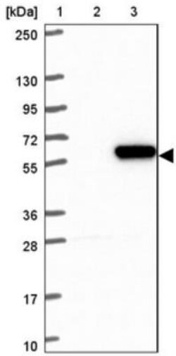 CYP4X1 Antibody, Novus Biologicals 0.1mL; Unlabeled:Antibodies, Polyclonal