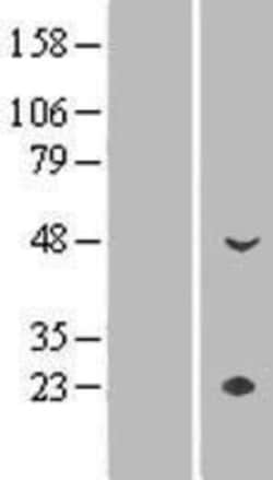 Novus Biologicals™ CYP4Z1 Overexpression Lysate