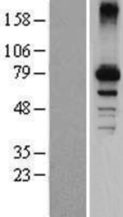 Novus Biologicals&trade;&nbsp;CYP7B1 Overexpression Lysate
