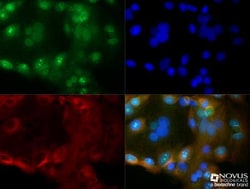 Cyr61/CCN1 Antibody - BSA Free, Novus Biologicals 0.025 mL | Buy Online | Novus Biologicals | Fisher Scientific