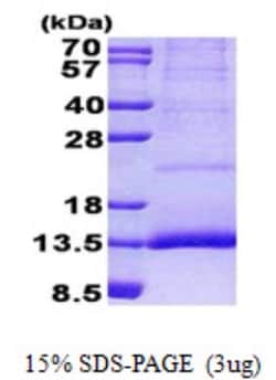Novus Biologicals&trade;&nbsp;Recombinant Human cystatin 11 His Protein