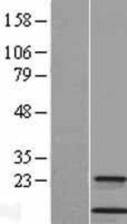 Novus Biologicals&trade;&nbsp;Cystatin A Overexpression Lysate
