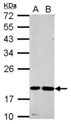 Cystatin F Antibody, Novus Biologicals 0.1mL; Unlabeled:Antibodies, Polyclonal