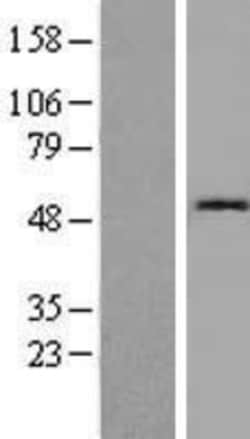 Novus Biologicals&trade;&nbsp;Cystatin SN Overexpression Lysate