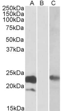 Cystatin-8 Antibody, Novus Biologicals 0.1mg; Unlabeled:Antibodies, Polyclonal