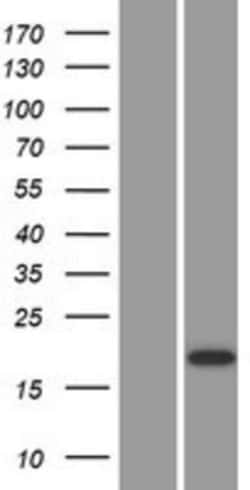 Novus Biologicals™ Cystatin-9 Overexpression Lysate