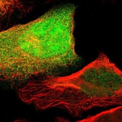 Integrin alpha 7 Antibody, Novus Biologicals:Antibodies:Primary Antibodies
