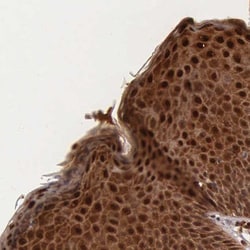 Integrin alpha 7 Antibody, Novus Biologicals:Antibodies:Primary Antibodies