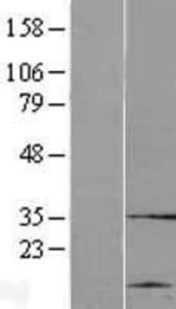 Novus Biologicals™ cysteine/histidine-rich 1 Overexpression Lysate