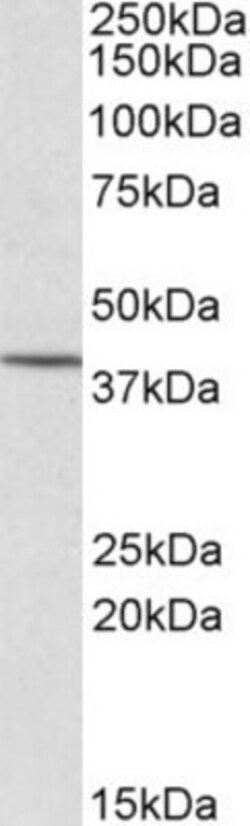 CYTIP Antibody, Novus Biologicals 0.1mg; Unlabeled:Antibodies, Polyclonal