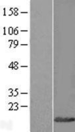 Novus Biologicals&trade;&nbsp;CYTL1 Overexpression Lysate