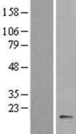Novus Biologicals&trade;&nbsp;Cytochrome b5 type A Overexpression Lysate