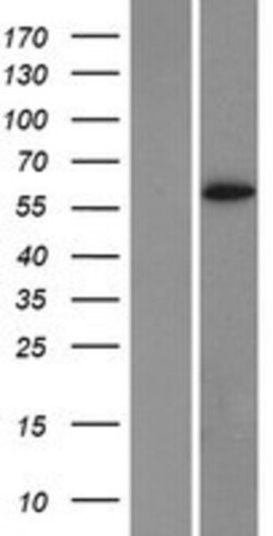 Novus Biologicals™ Cytochrome P450 1A2 Overexpression Lysate