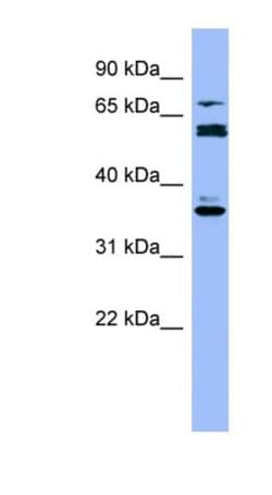 Cytochrome P450 2B6 Antibody, Novus Biologicals:Antibodies:Primary Antibodies