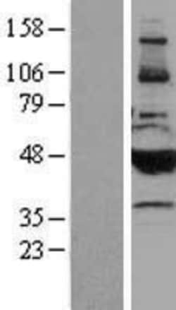 Novus Biologicals™ Cytochrome P450 2B6 Overexpression Lysate