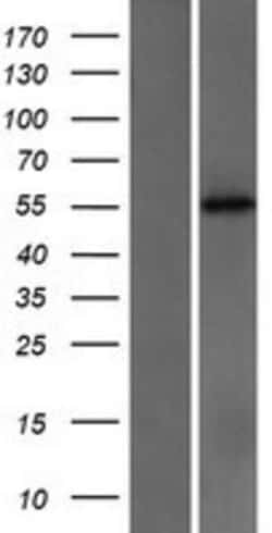 Novus Biologicals™ Cytochrome P450 2C18 Overexpression Lysate