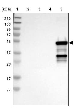 Cytochrome P450 2C9 Antibody, Novus Biologicals 25 &mu;L; Unlabeled:Antibodies,