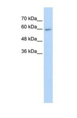 Cytochrome P450 4F11 Antibody, Novus Biologicals 100 &mu;L | Buy Online | Novus Biologicals | Fisher Scientific