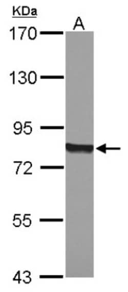 POR/Cytochrome P450 Reductase Antibody, Novus Biologicals 0.1mL; Unlabeled:Antibodies,
